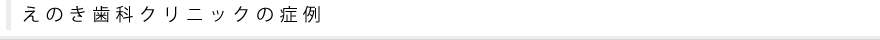 えのき歯科クリニックの症例